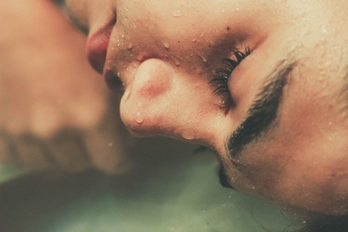 What You Need To Know About Acne Scars and Its Treatments